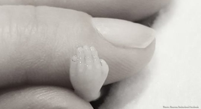 An Aborted Child